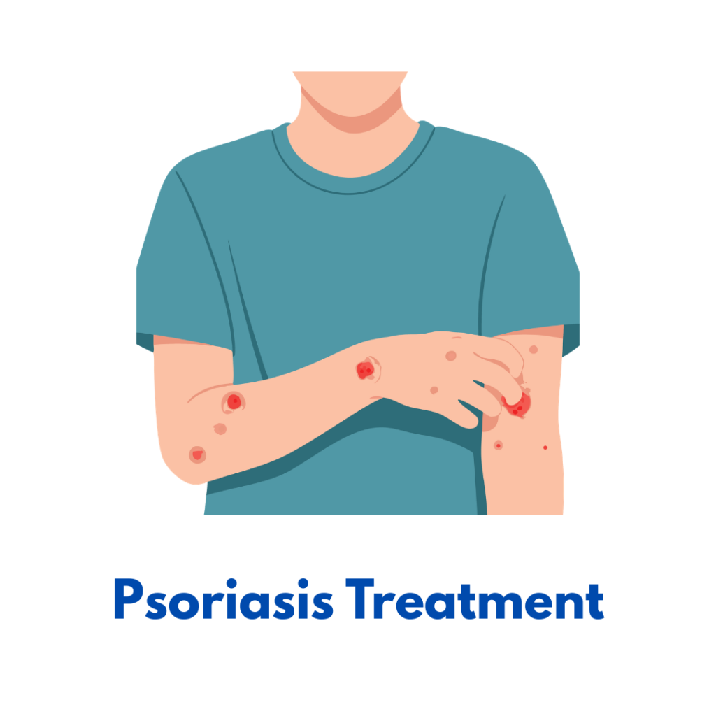 Psoriasis homeopathy treatment for natural skin healing