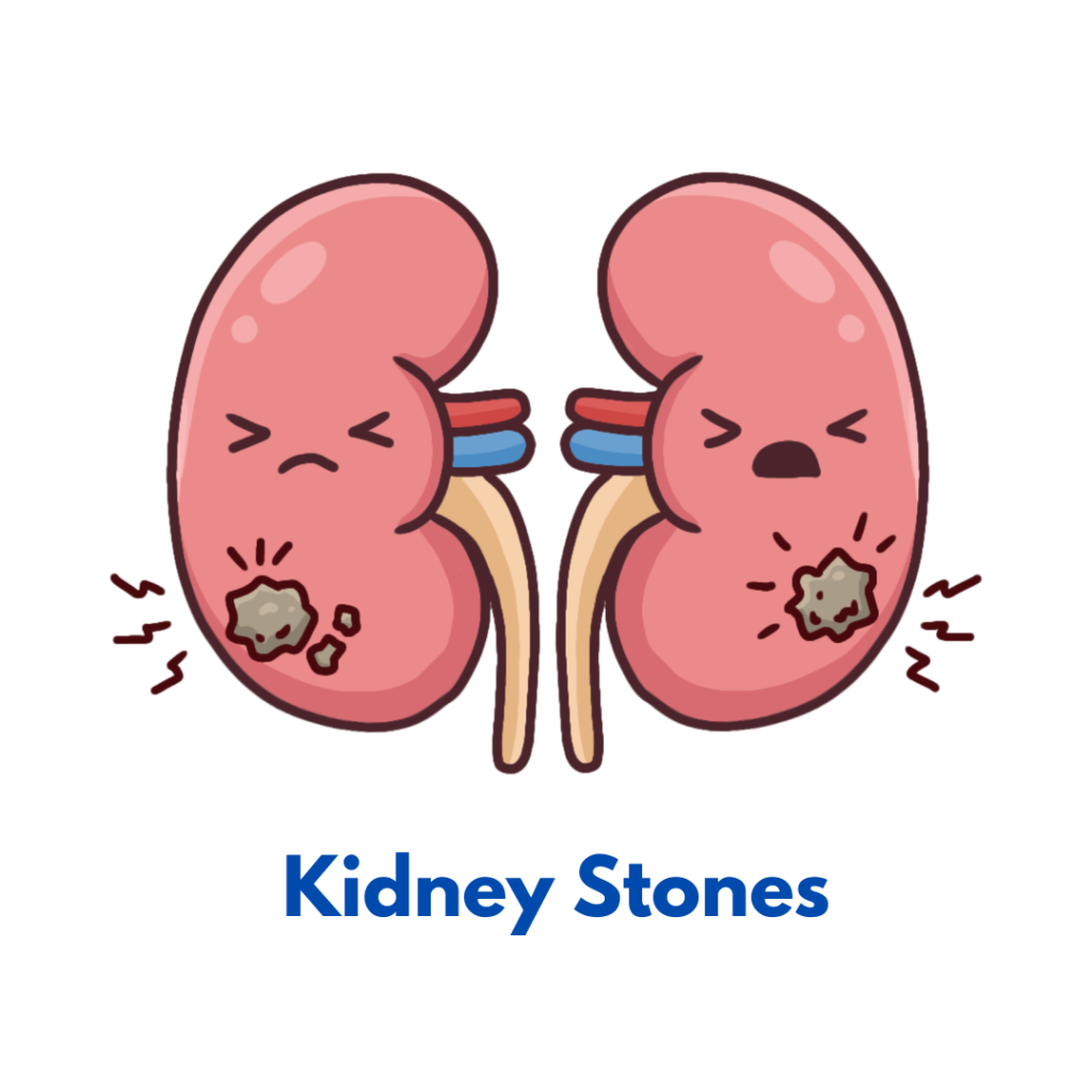 Kidney stone homeopathy treatment for natural pain relief