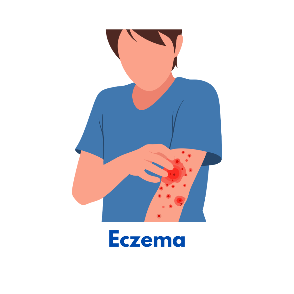 Arthritis homeopathy treatment for joint pain and inflammation